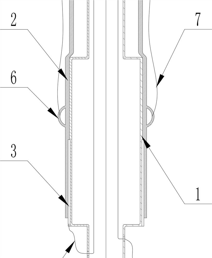 Detachable gastroscope cannula with inflatable airbag