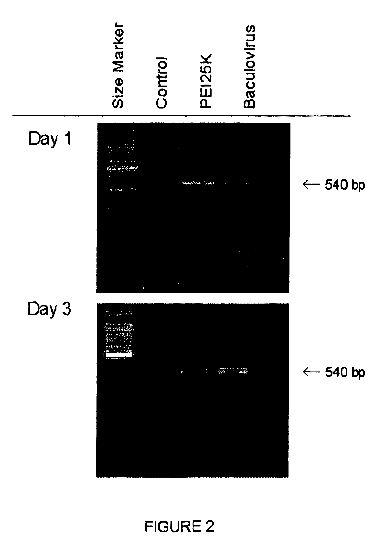 Method of delivery of nucleic acids to peripheral neurons