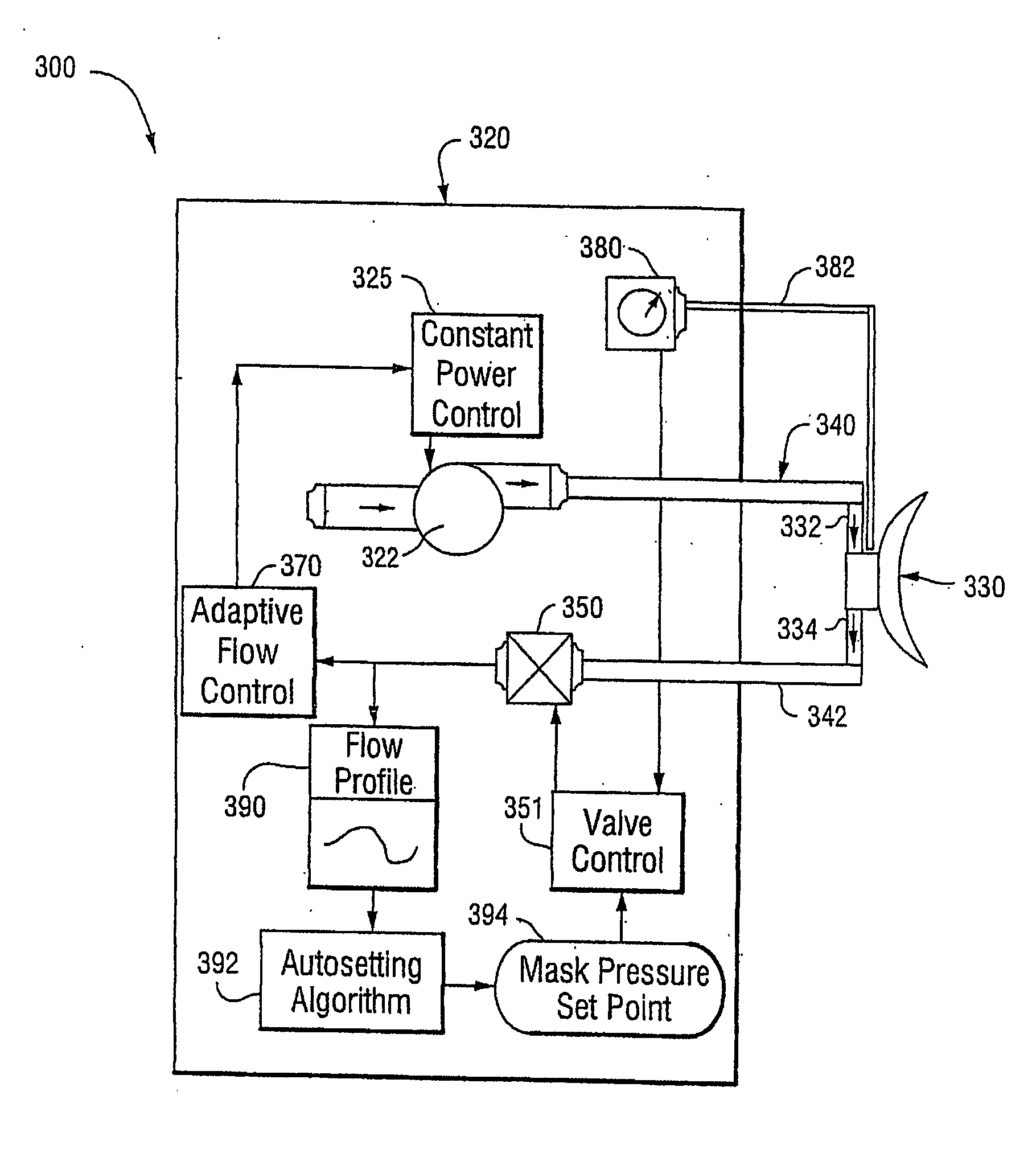 Mask Pressure Regulation in Cpap Treatment and Assisted Respiration by Dynamic Control of Mask Vent Flow