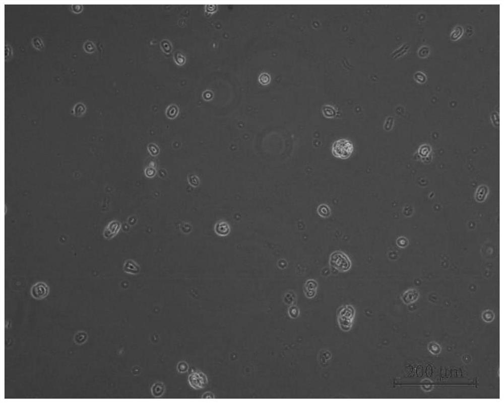 Isolated culture method of rumen epithelial cells of adult yak