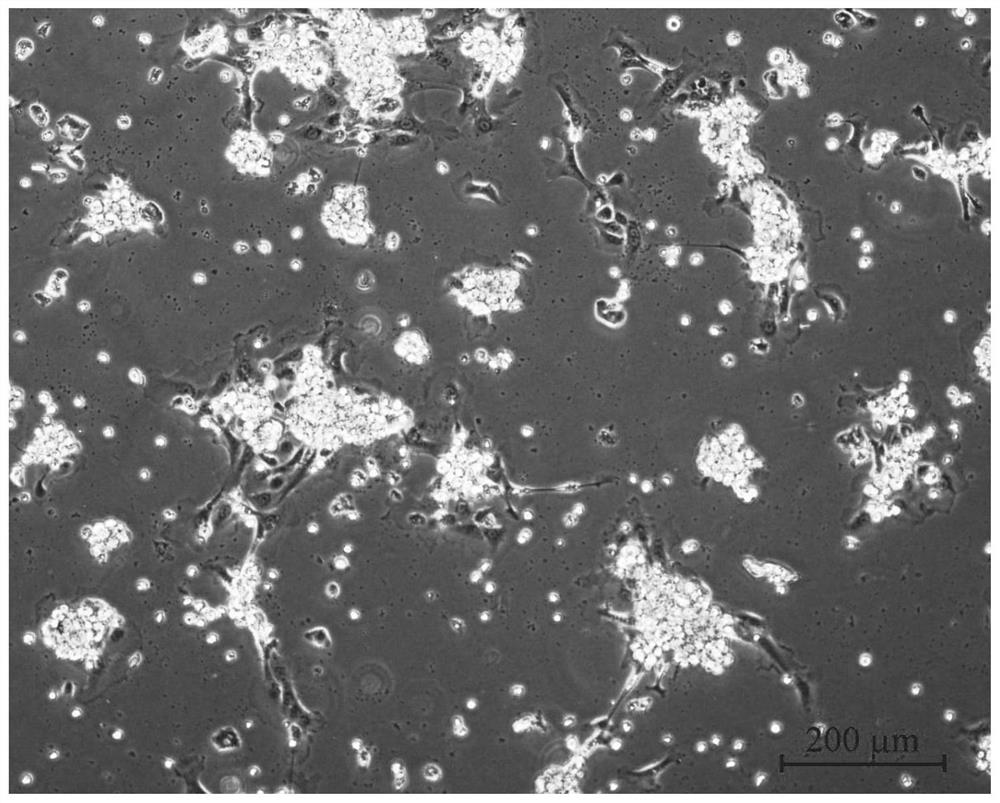 Isolated culture method of rumen epithelial cells of adult yak