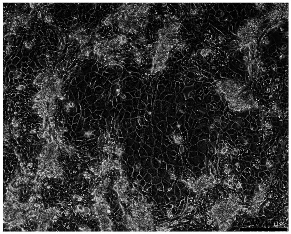 Isolated culture method of rumen epithelial cells of adult yak