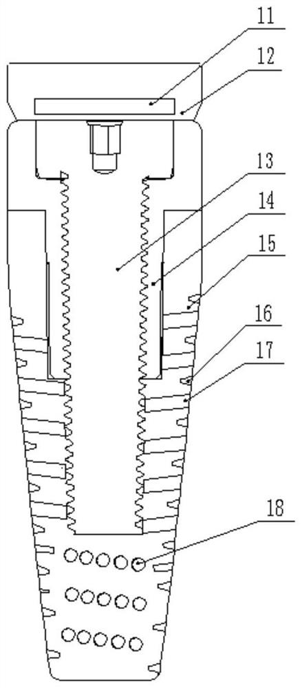 Dental implant and dental implant manufacturing method