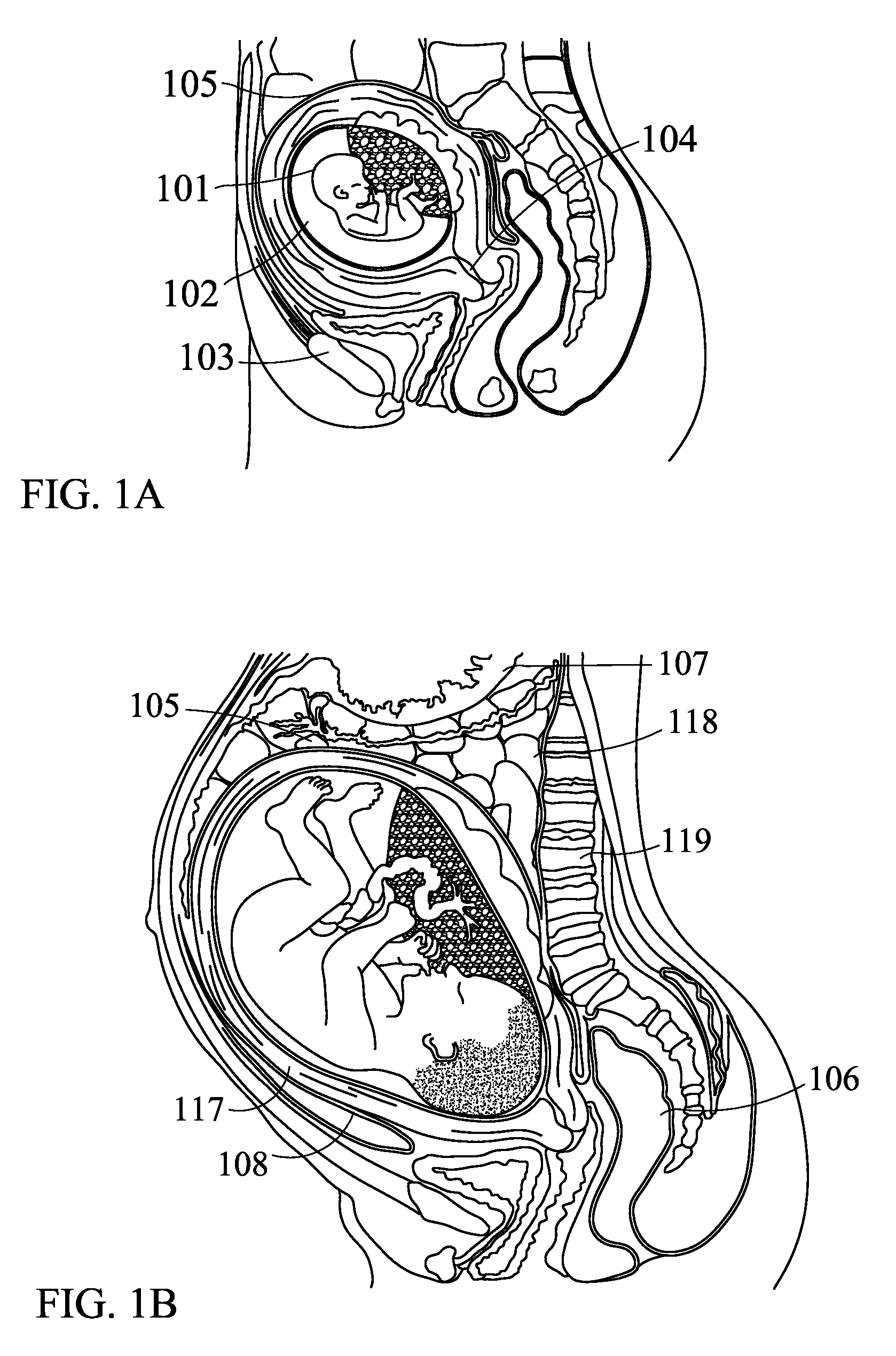 Fetal communication system