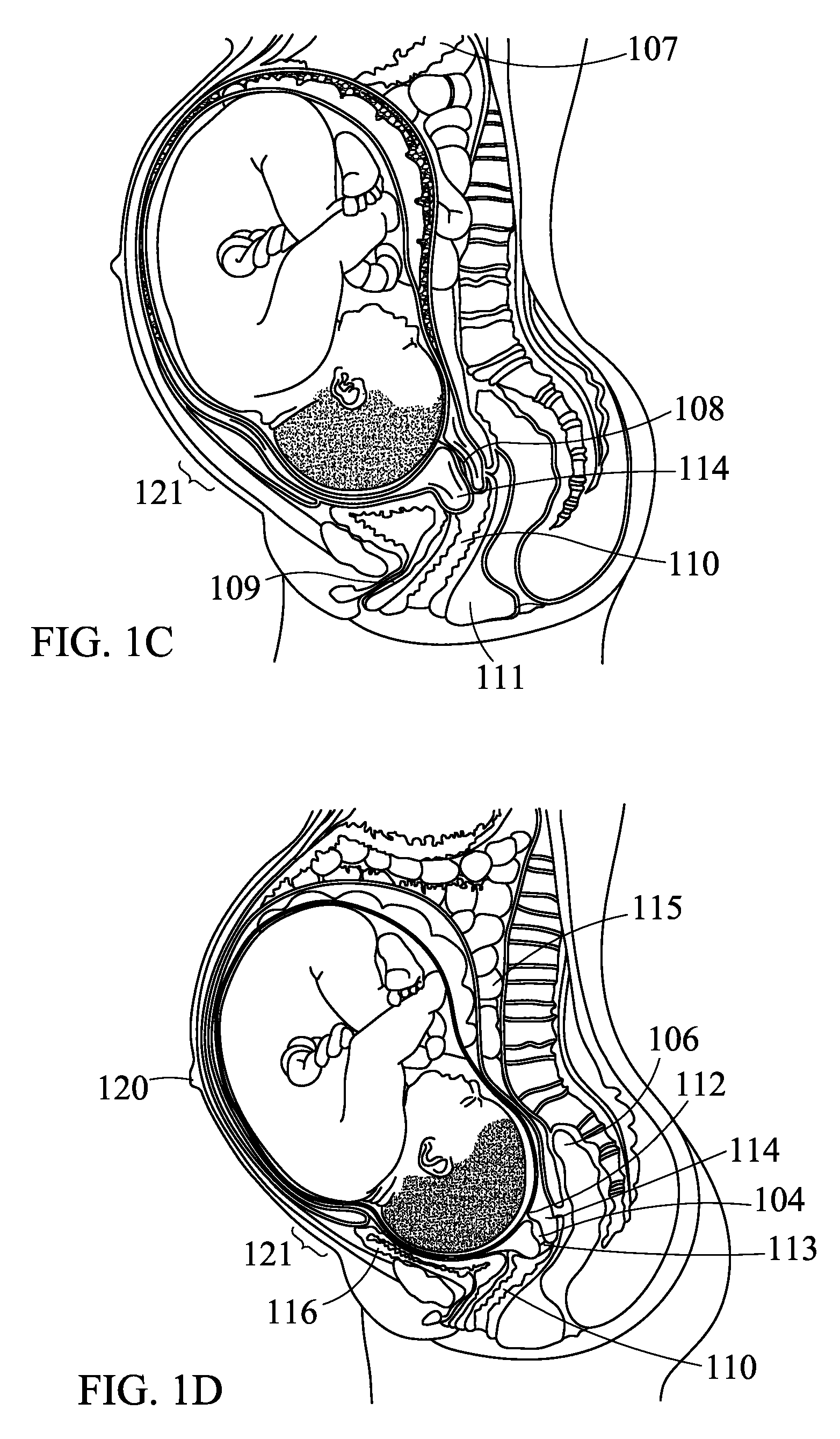 Fetal communication system