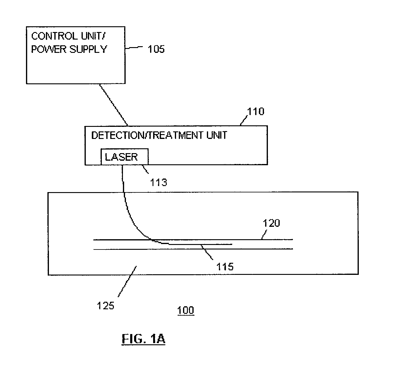 Devices for detection and therapy of atheromatous plaque