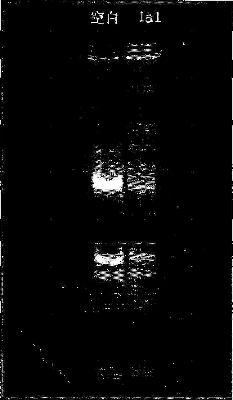 Gamma-carbolines derivates as well as preparation method and application thereof