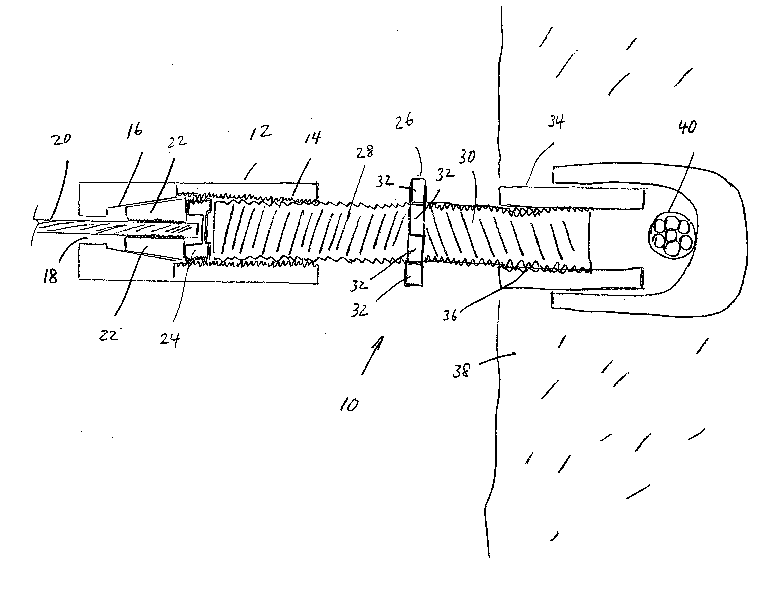 Tensioning anchor suitable for blind-hole tendon anchoring and tendon repair