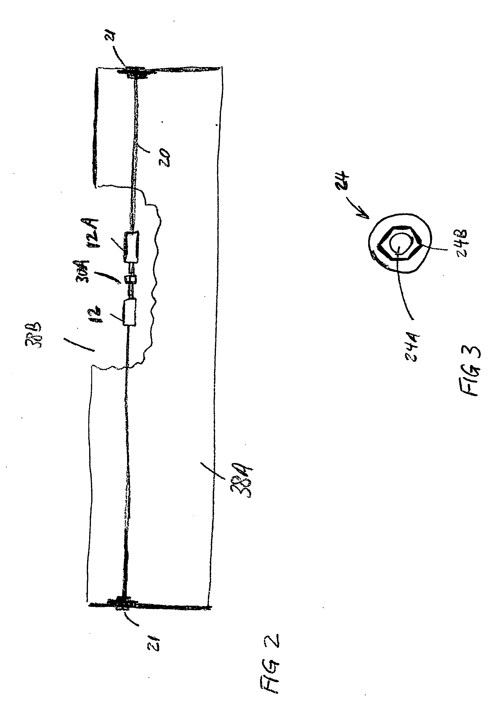 Tensioning anchor suitable for blind-hole tendon anchoring and tendon repair