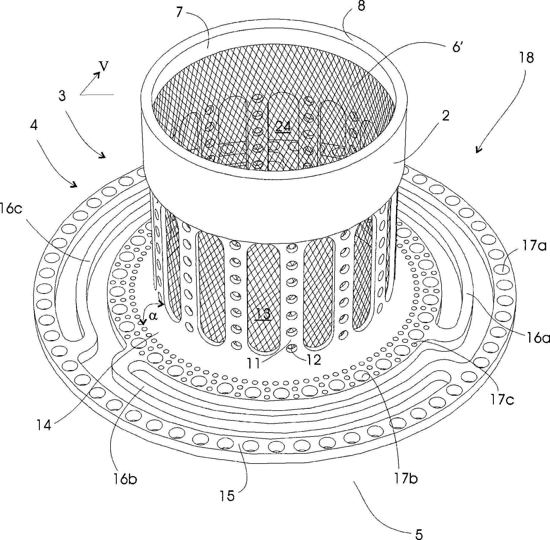 Implant and manufacture method thereof