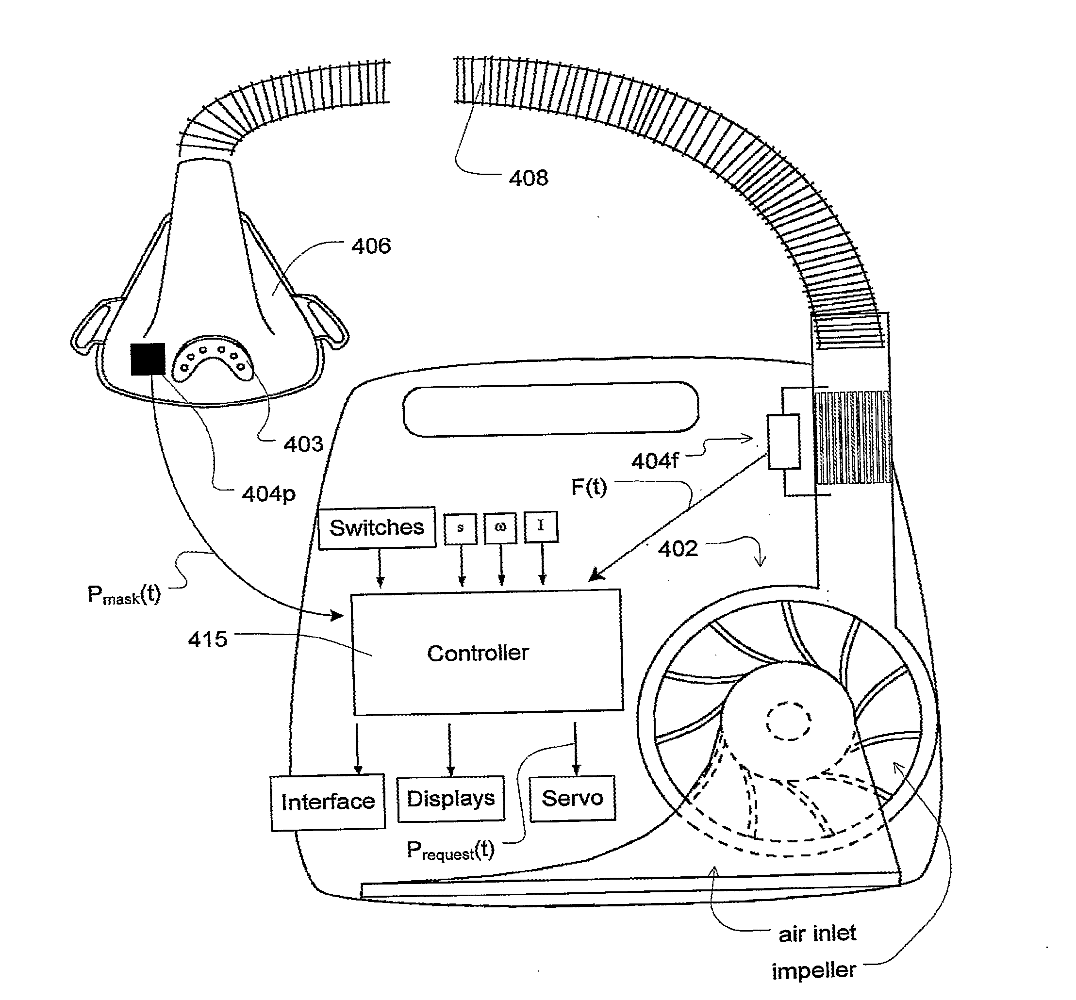 Automated control for detection of flow limitation