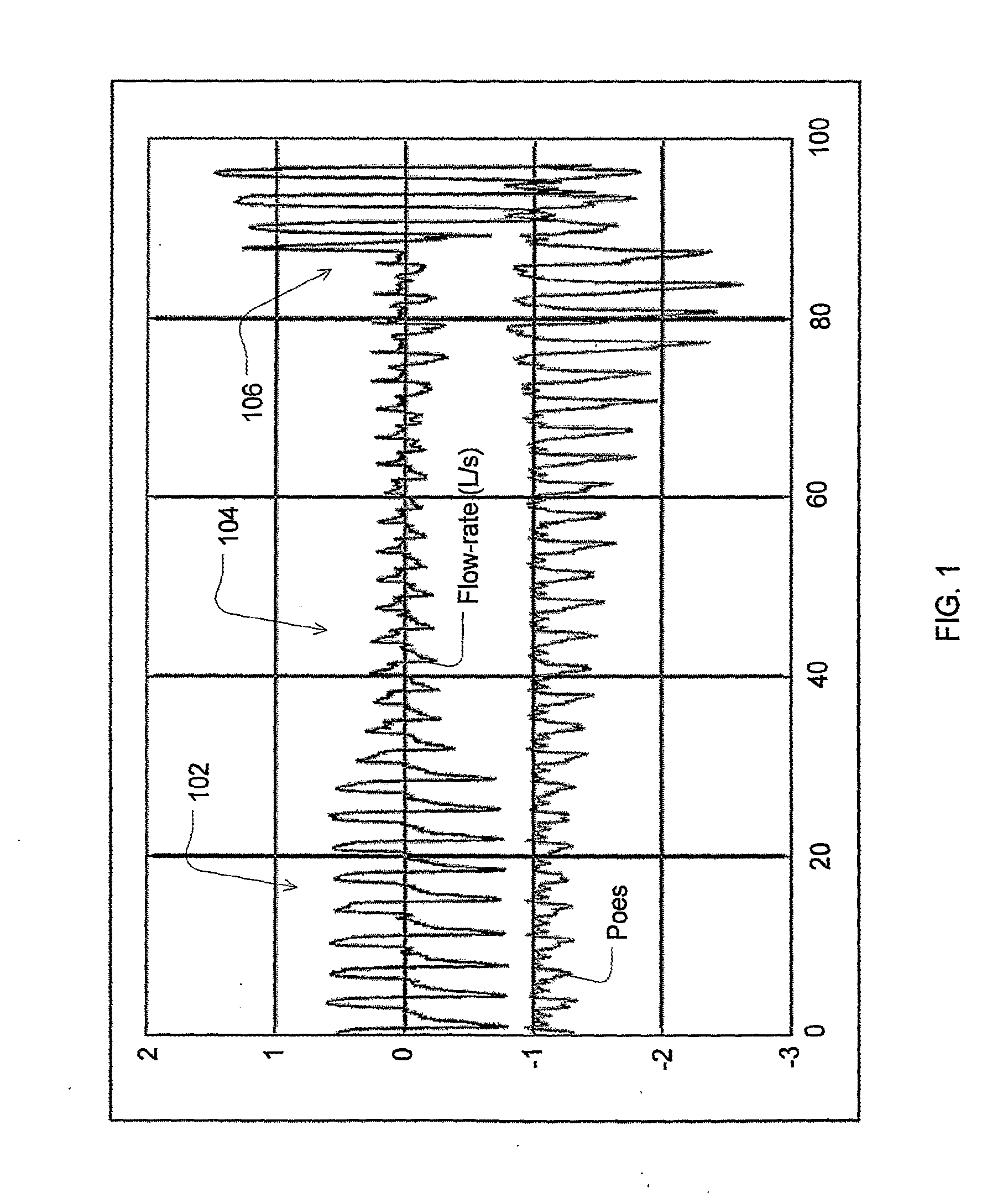 Automated control for detection of flow limitation