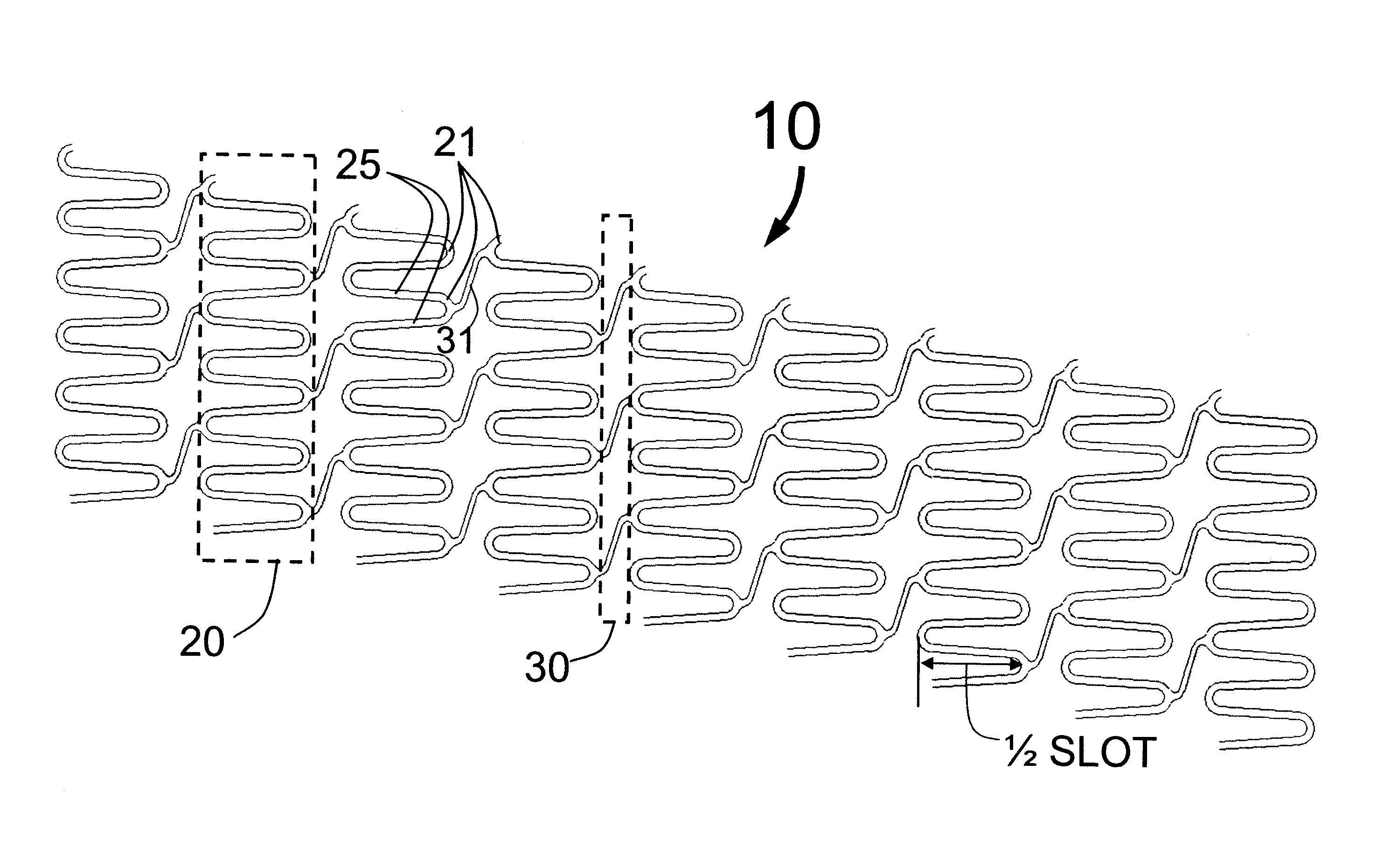 Hybrid stent with helical connectors