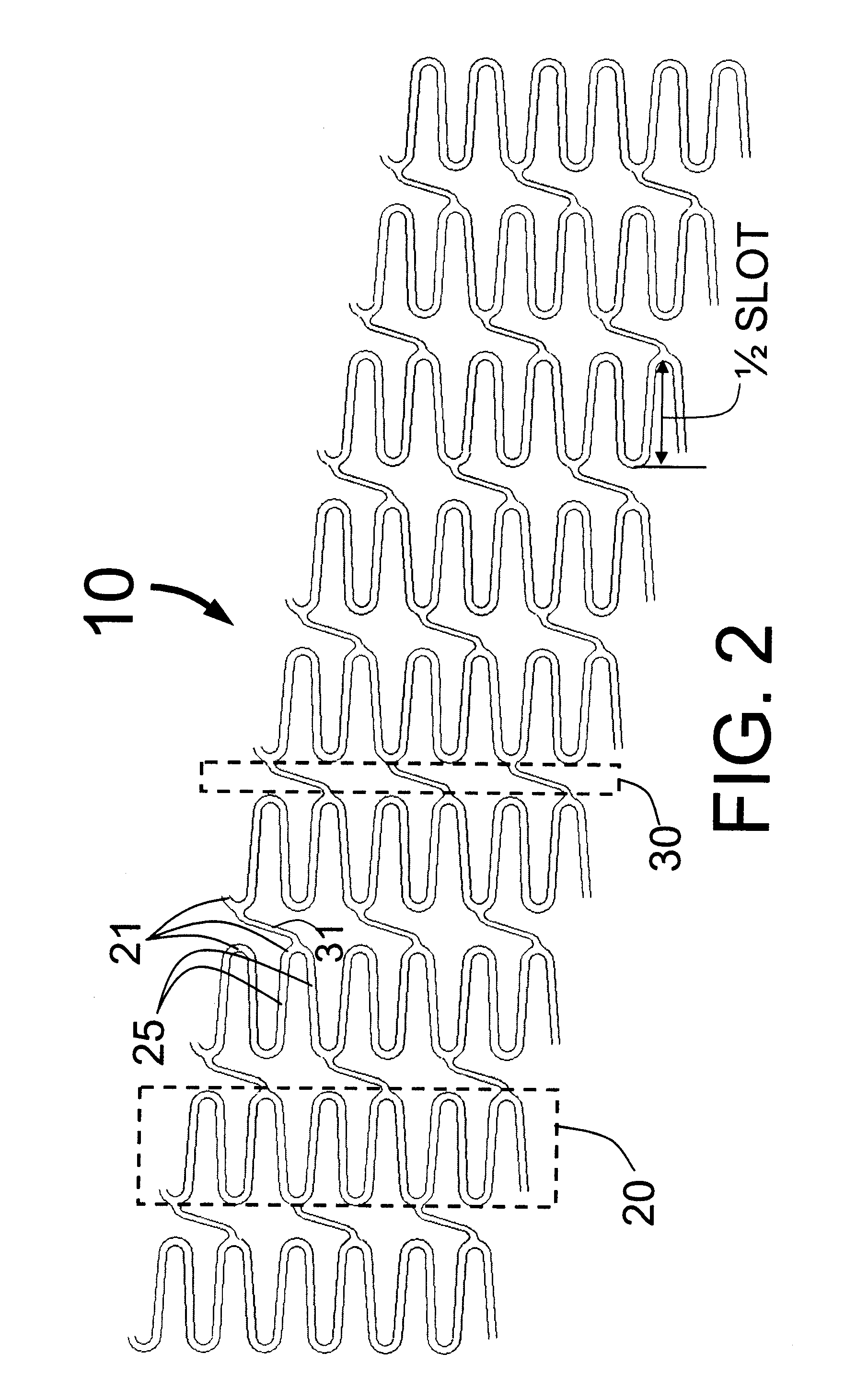 Hybrid stent with helical connectors