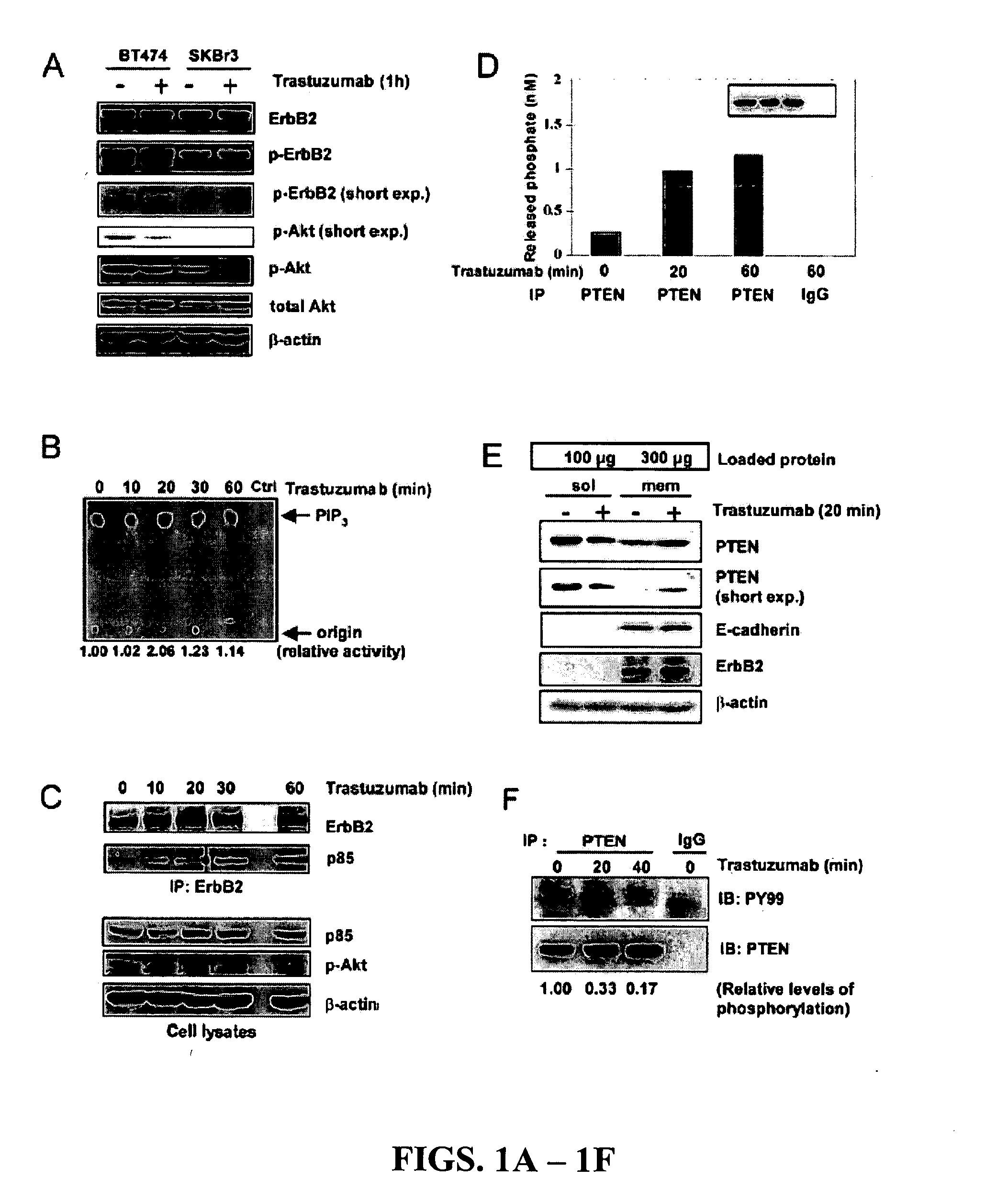 Diagnostic and therapeutic methods and compositions involving PTEN and breast cancer