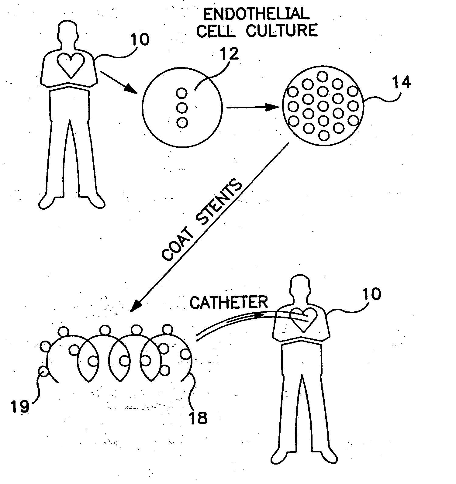 Implantable system with drug-eluting cells for on-demand local drug delivery