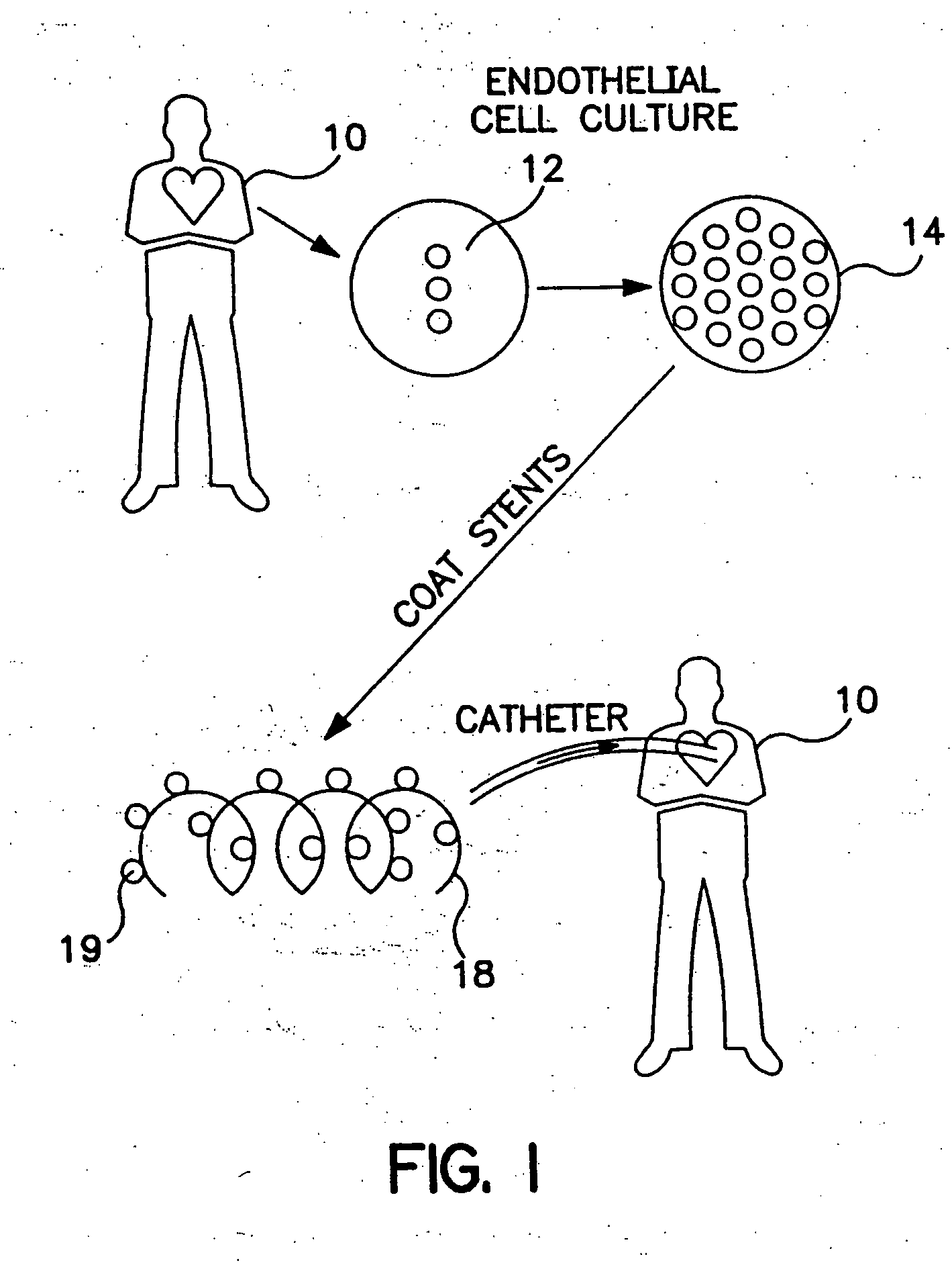 Implantable system with drug-eluting cells for on-demand local drug delivery