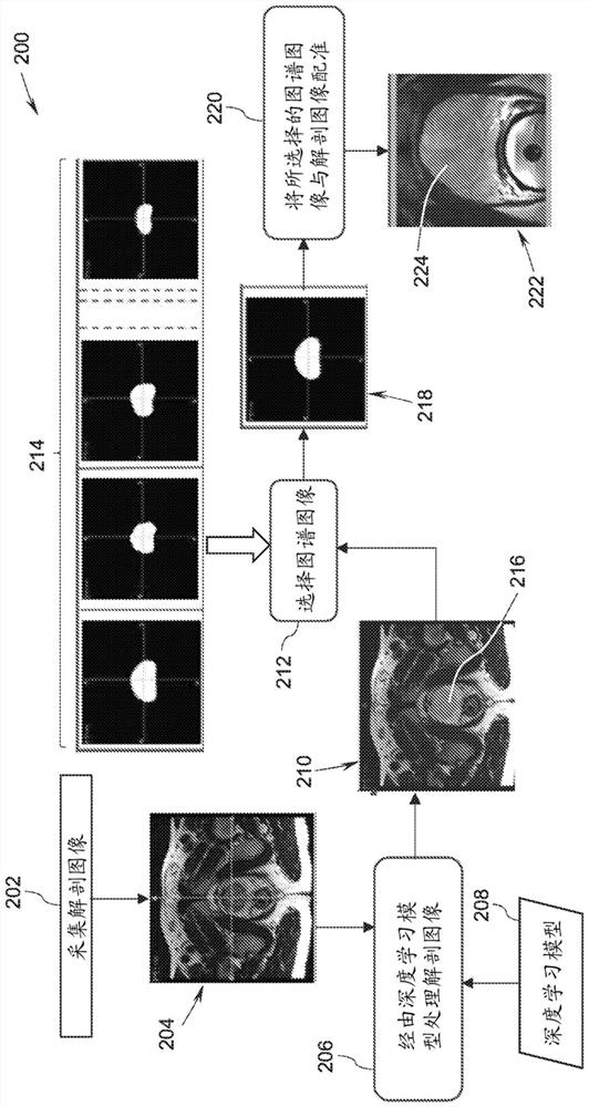 System and method for accelerated clinical workflow