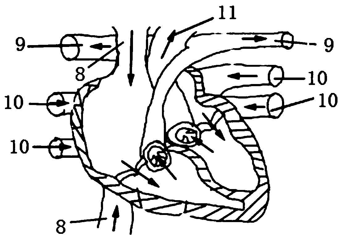 Assisted teaching device for cardiac interventional operation