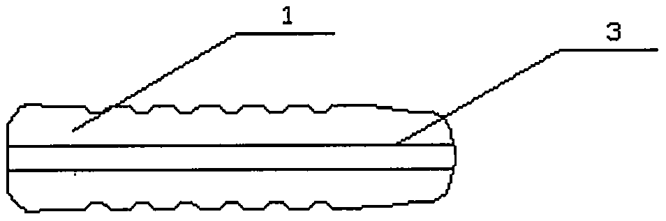 A novel degradable bone implant and its preparation method