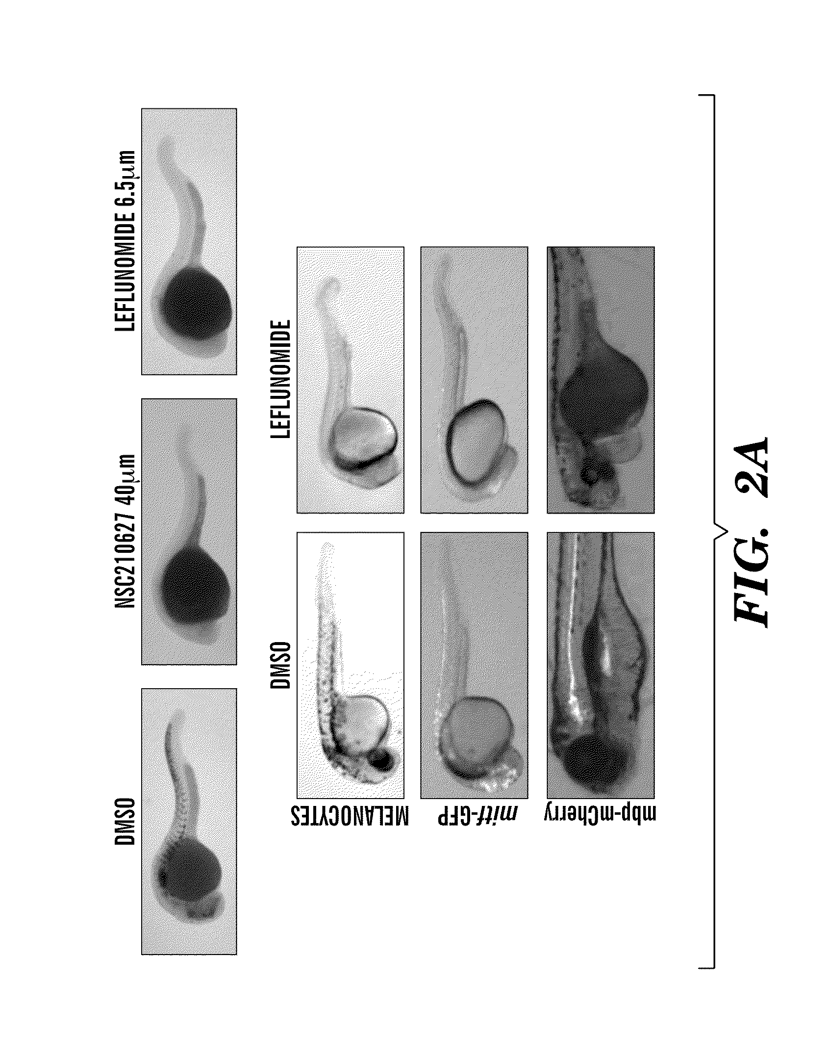 Methods for treatment of melanoma