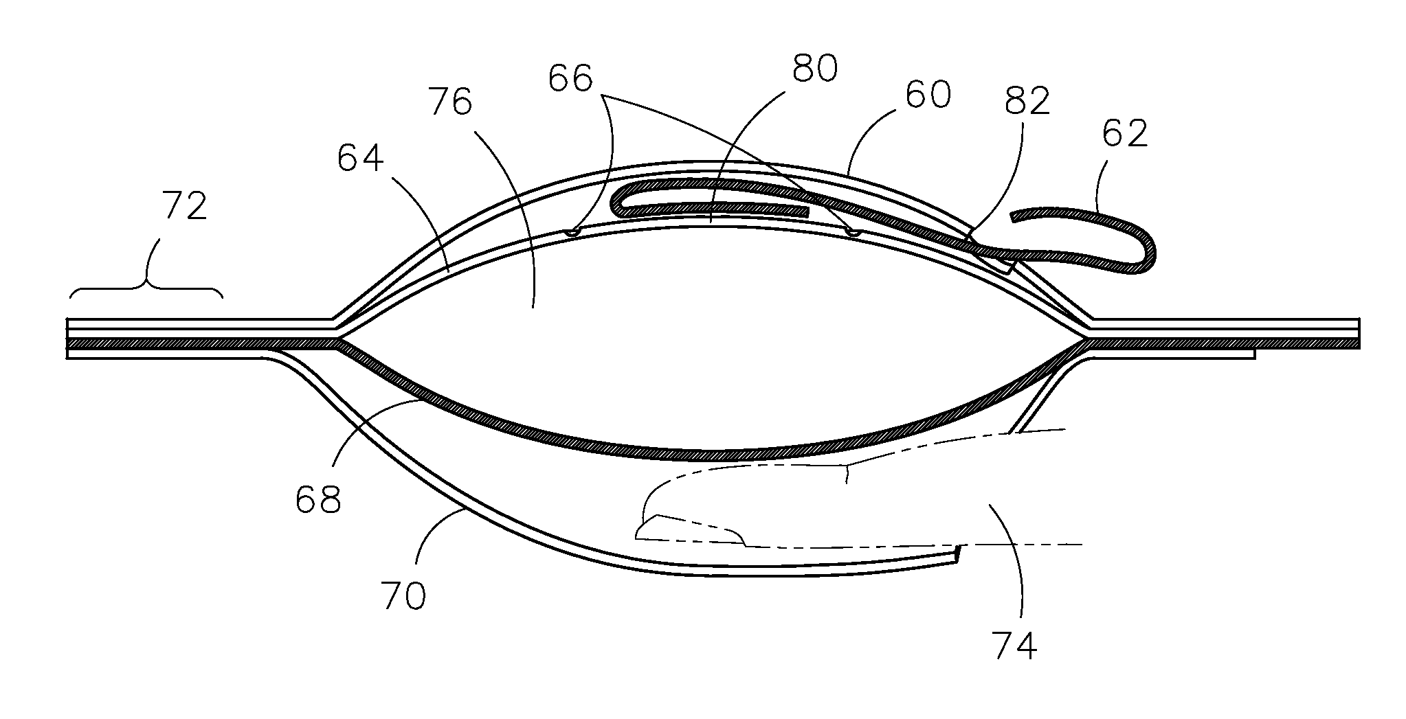 Disposable fluid applicator