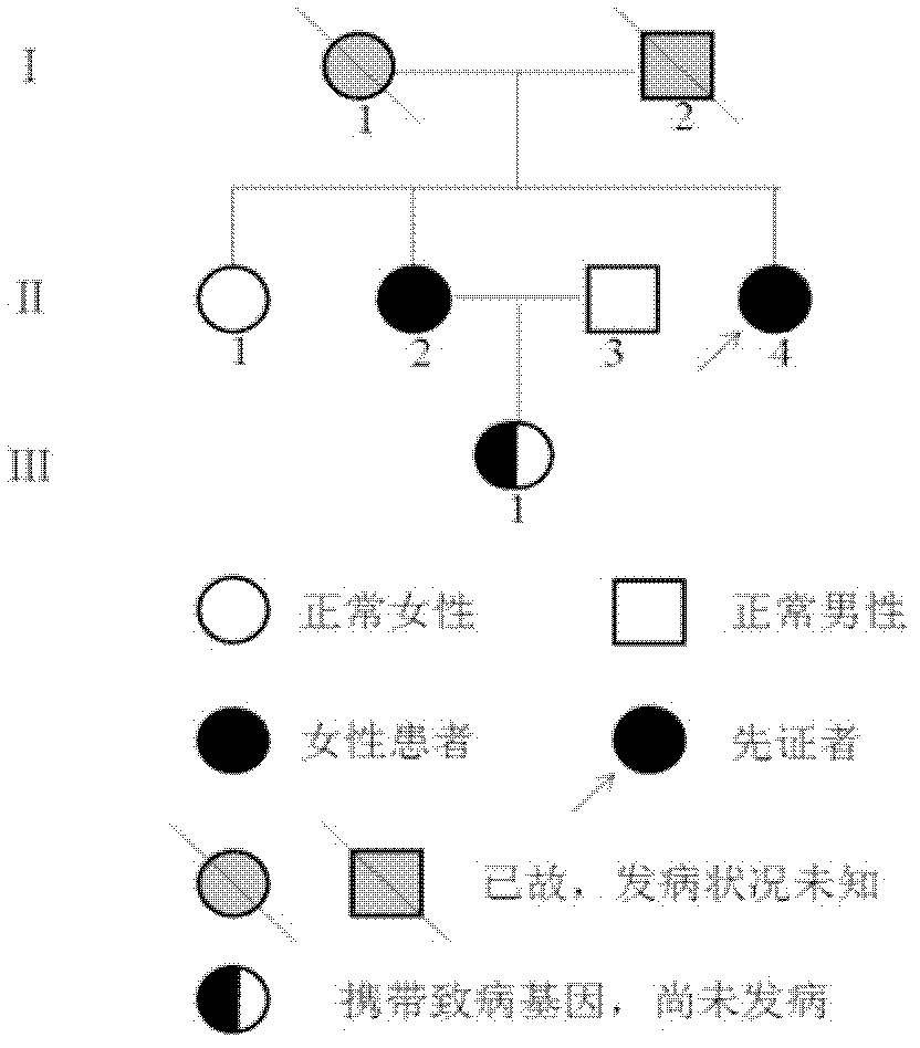 Alzheimer disease pathogenic gene and application thereof