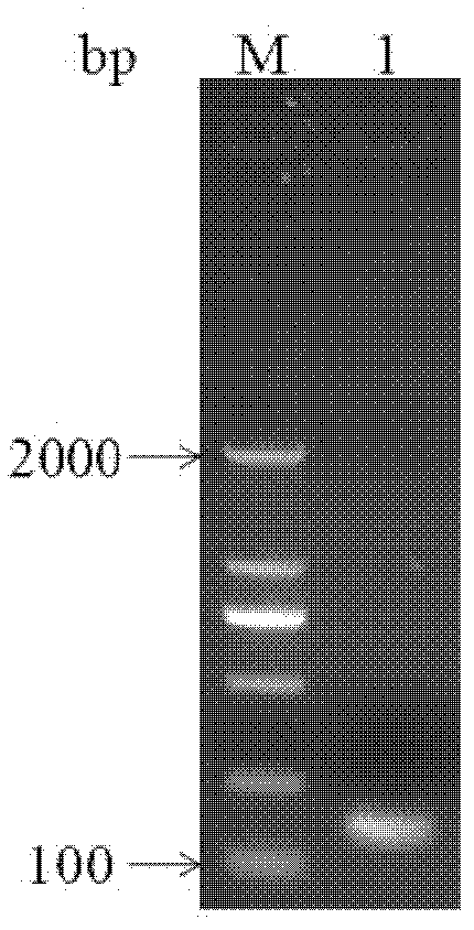 Alzheimer disease pathogenic gene and application thereof