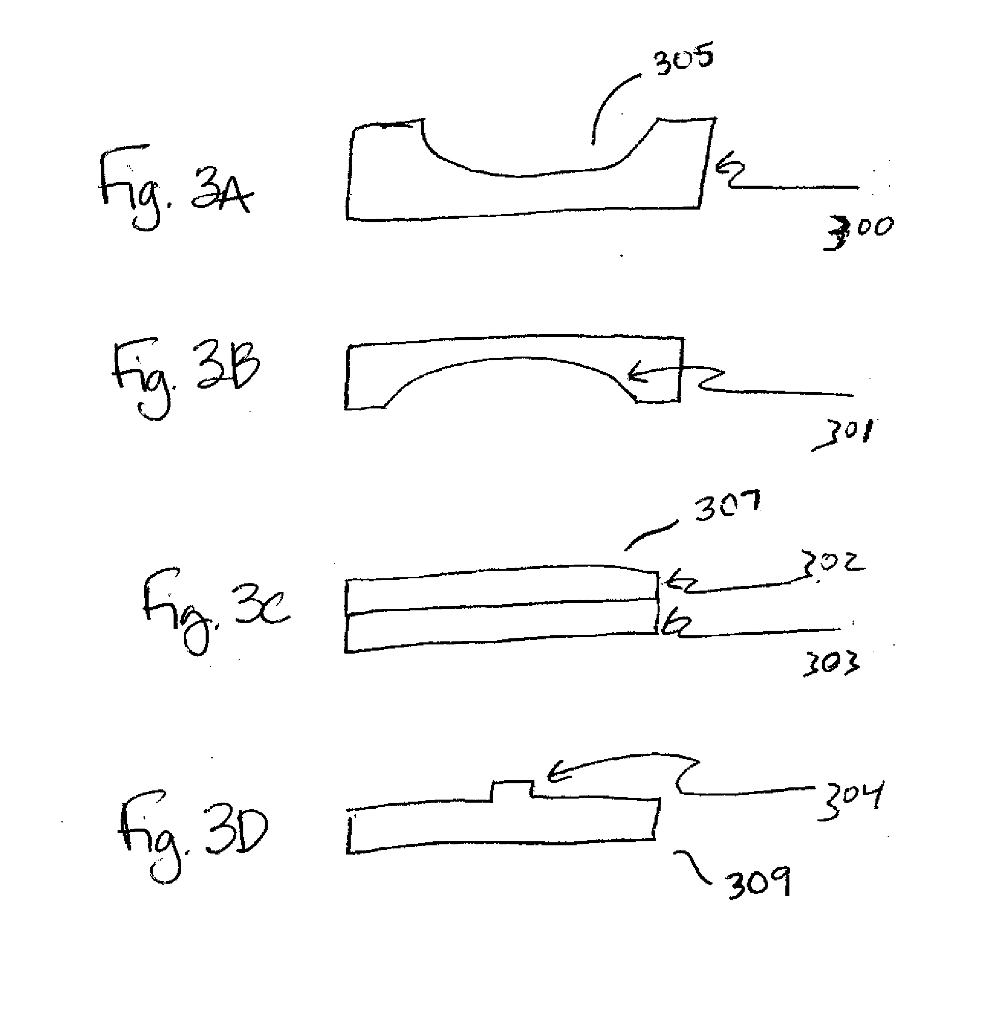 Apparatus and Method for Removing Epithelium from the Cornea