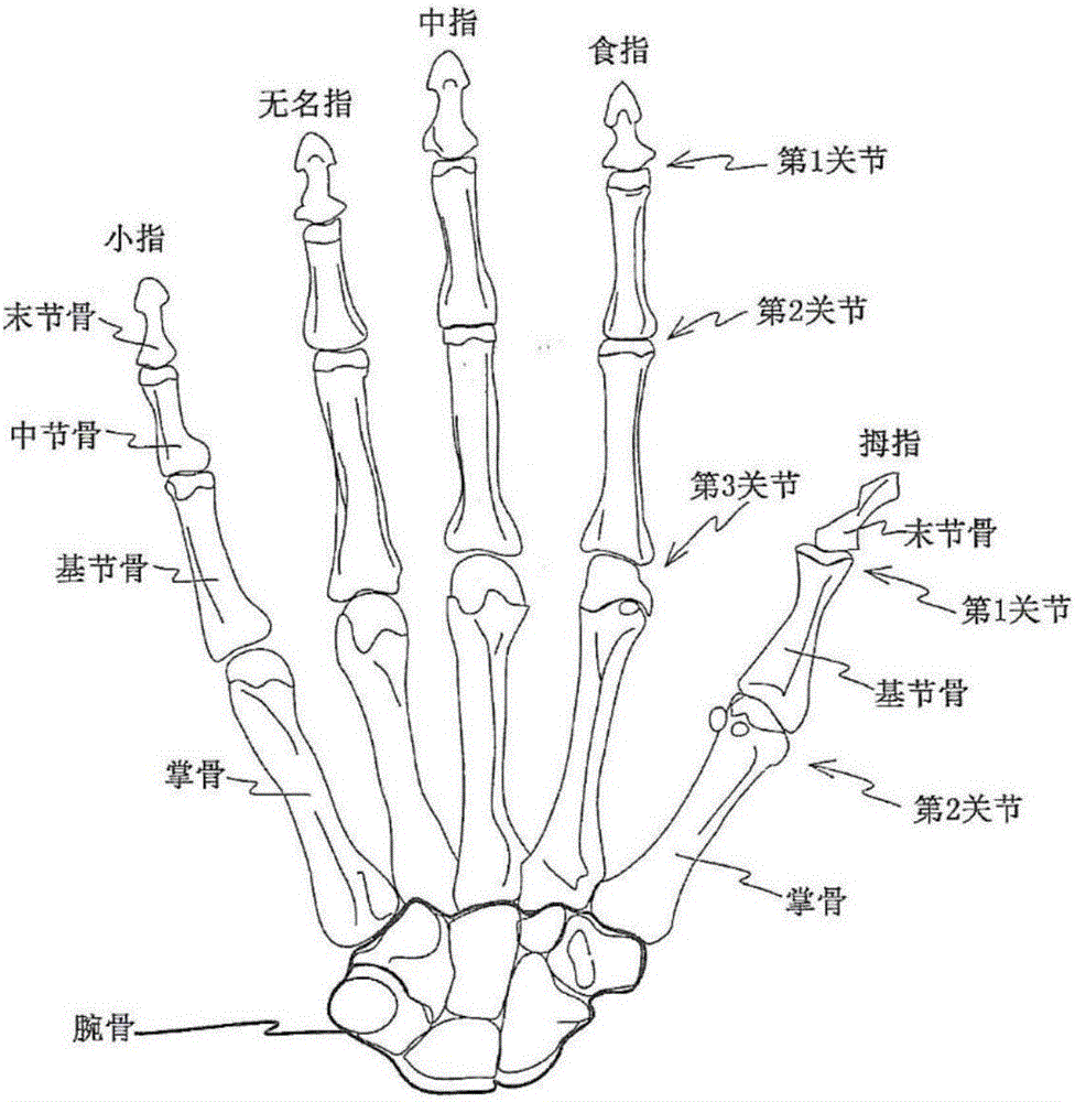 Joint movement assist device independently assisting joint