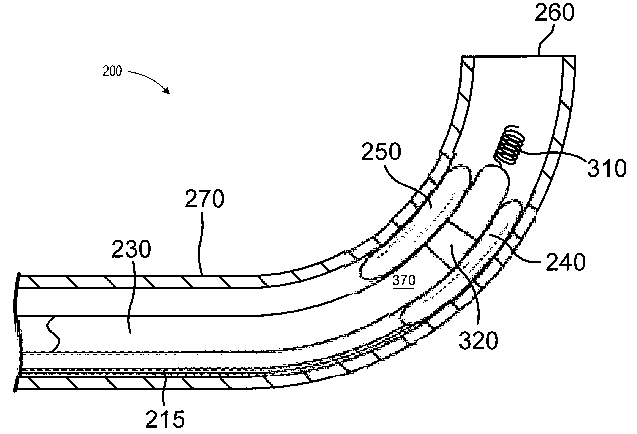 Catheter lead placement system and method