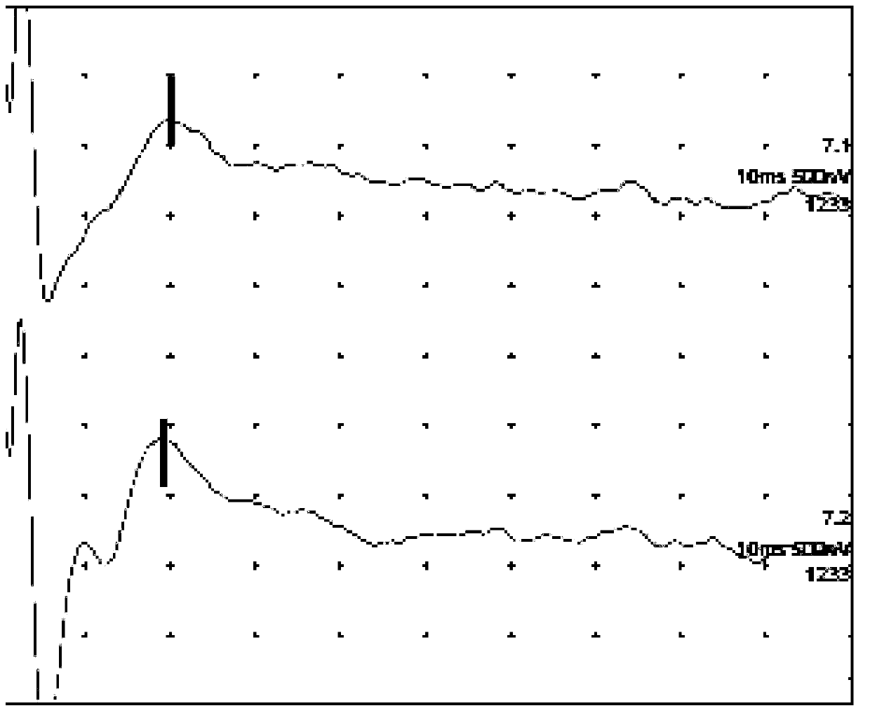 Electrophysiological test method of automatic auditory brainstem implant