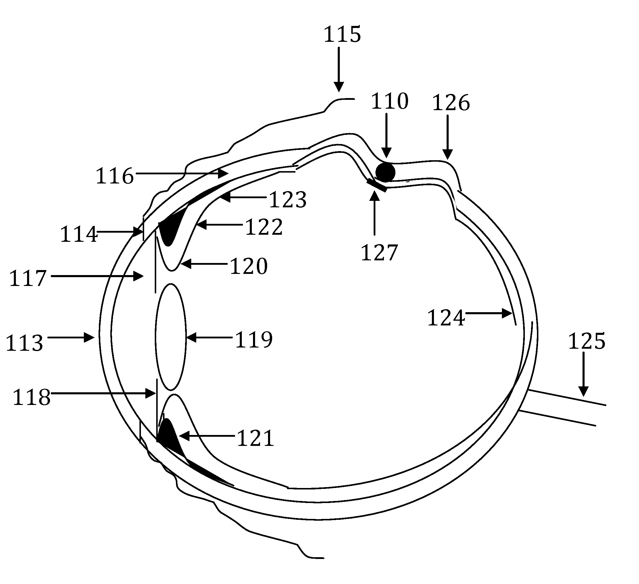 Device and method for treatment of retinal detachment and other maladies of the eye