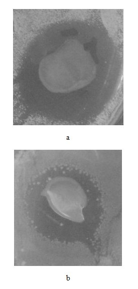 Preparation method of chitosan-based antibacterial membrane material