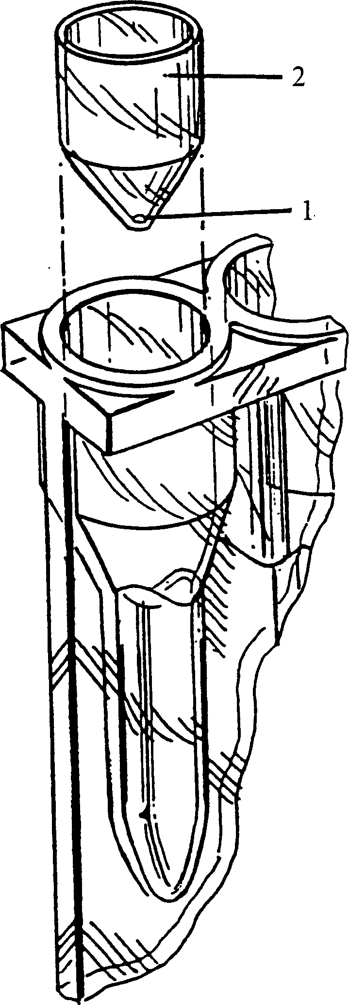 Agglutination reaction and separation vessel