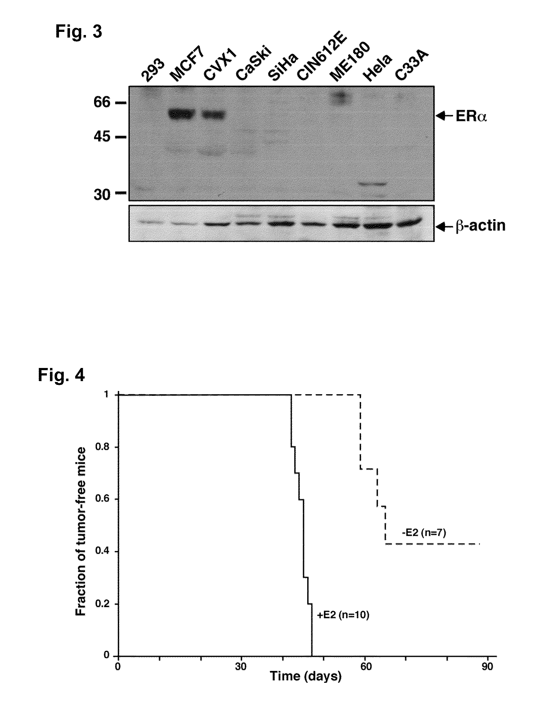 Therapeutic treatment of cancer and dysplasia of the cervix or vagina using estrogen antagonists