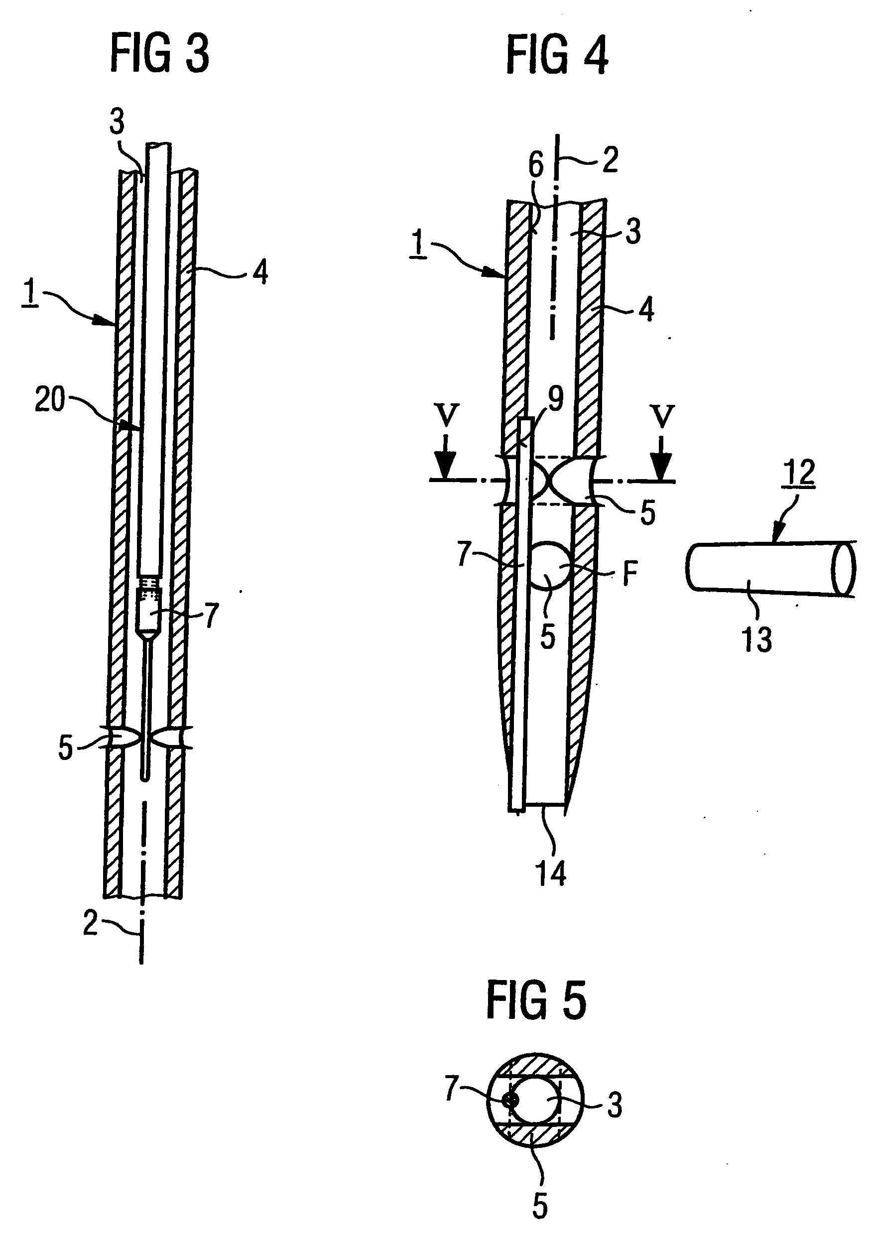 Surgical nail