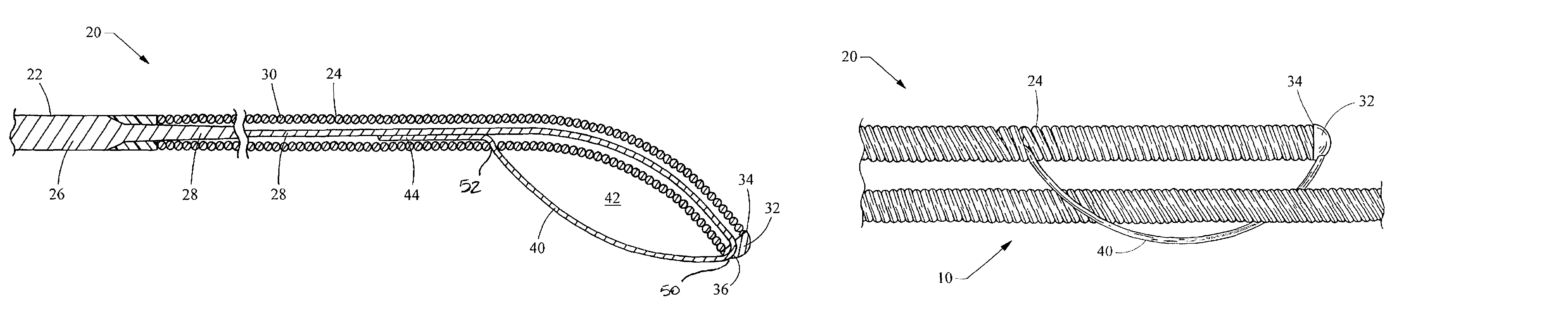 Coupling wire guide