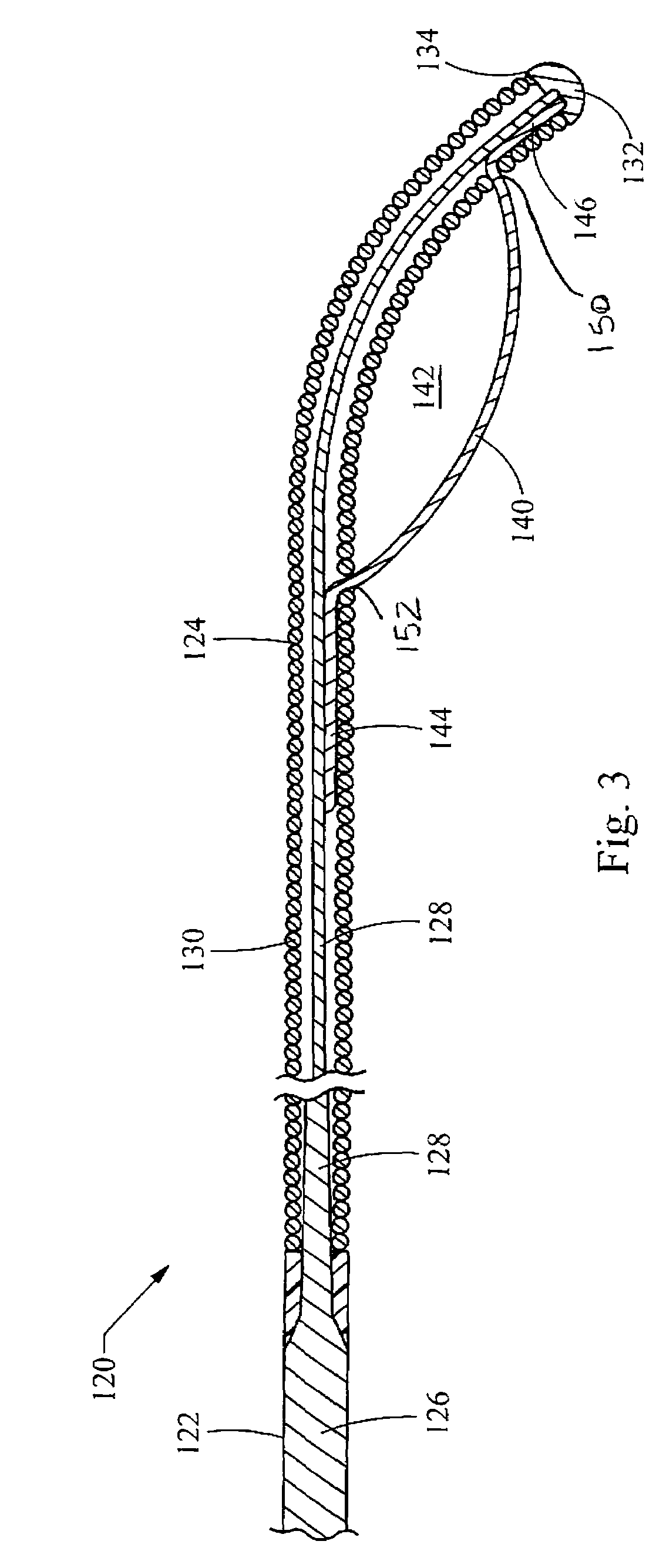 Coupling wire guide