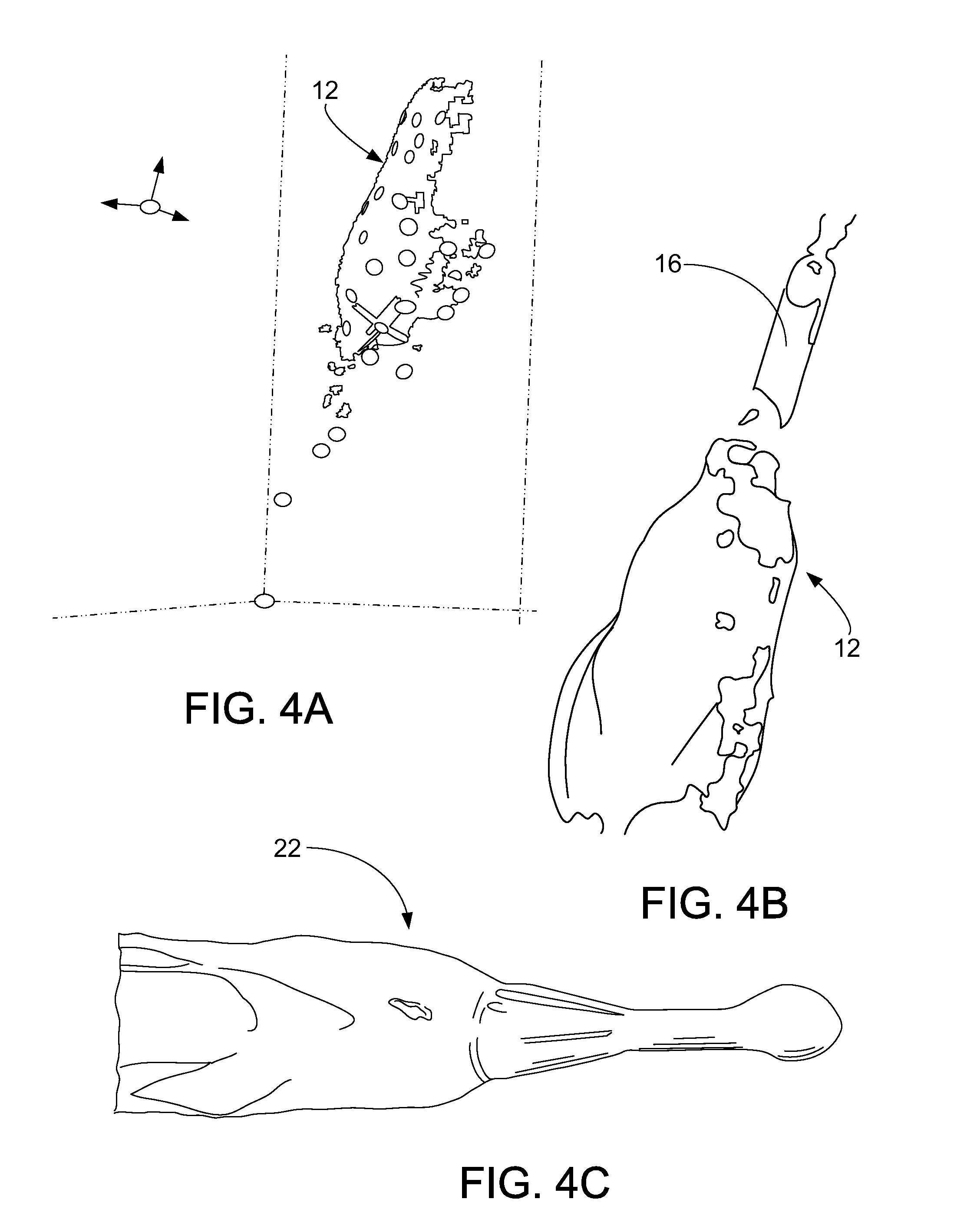 Method of digitally constructing a prosthesis