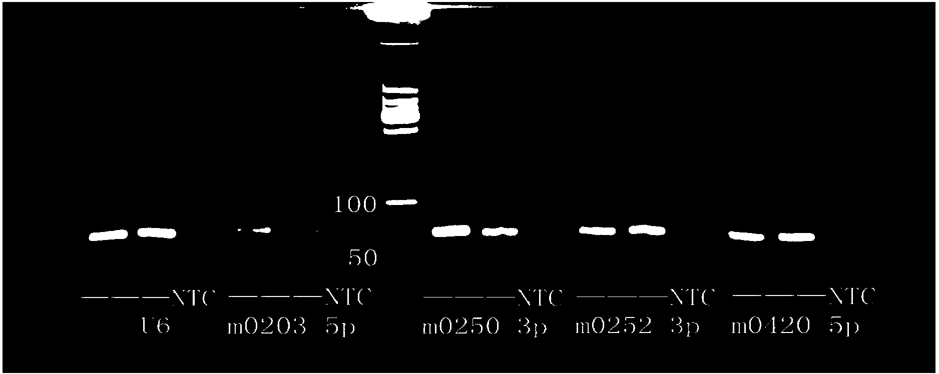 Shellfish sn RNA U6 gene, primer, and applications thereof