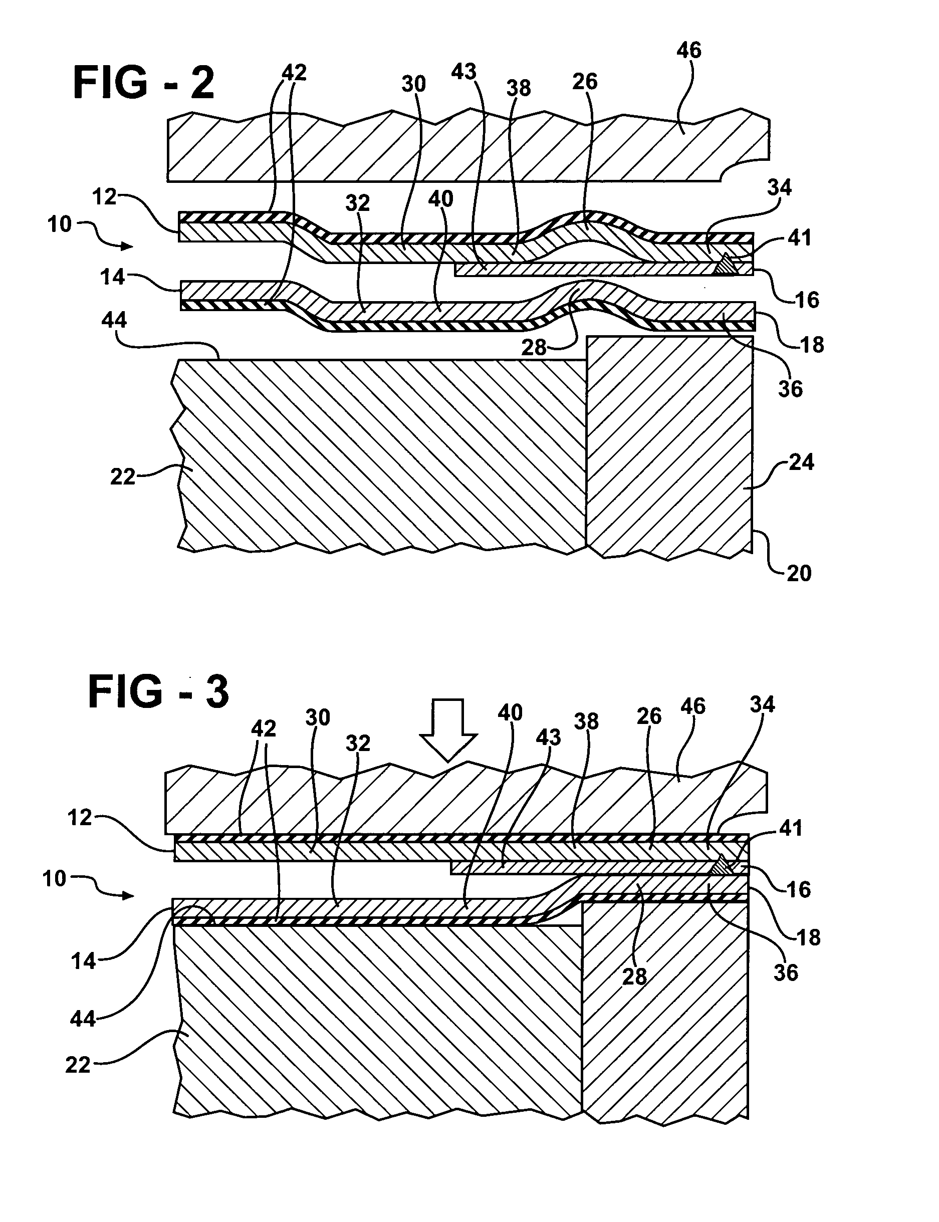 Metal gasket