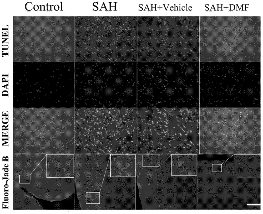 Application of dimethyl fumarate to preparation of medicine for treating early brain injury (EBI) after subarachnoid hemorrhage (SAH)