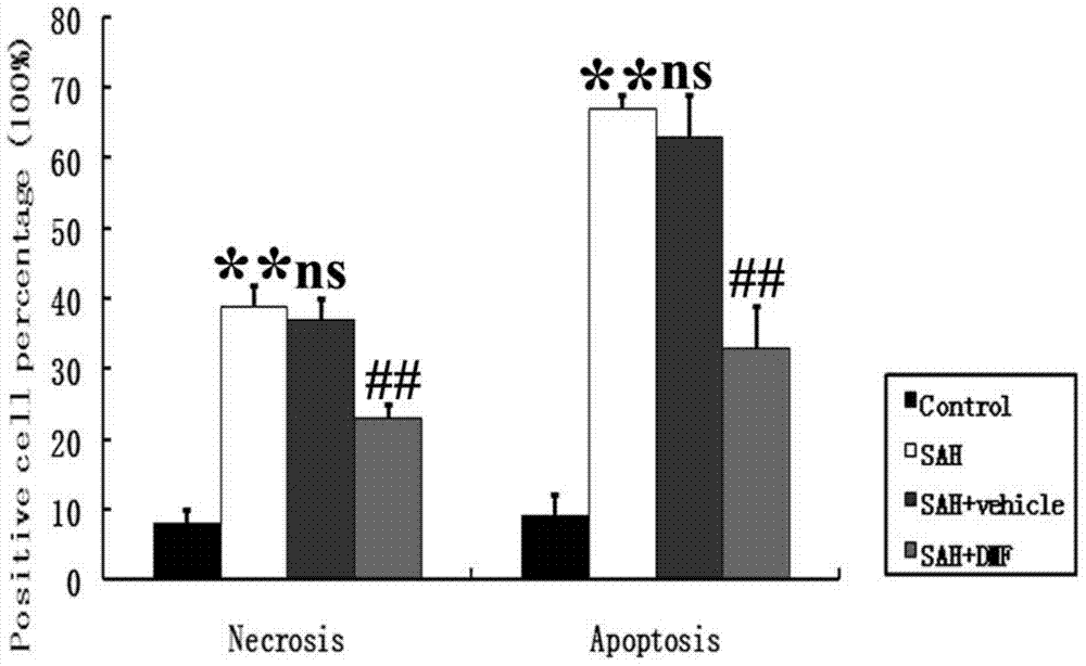 Application of dimethyl fumarate to preparation of medicine for treating early brain injury (EBI) after subarachnoid hemorrhage (SAH)