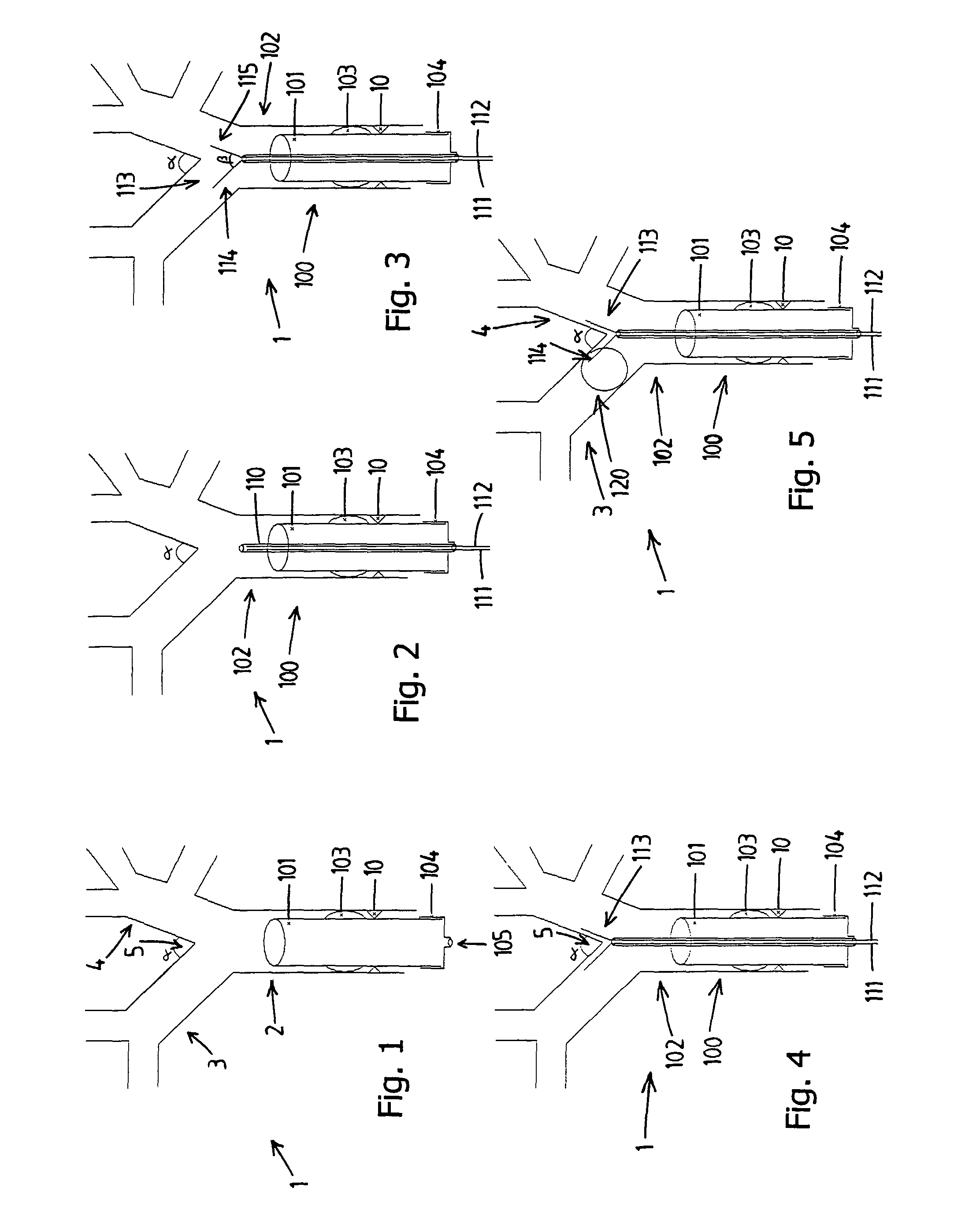 Bronchus blocker and artificial respiration system