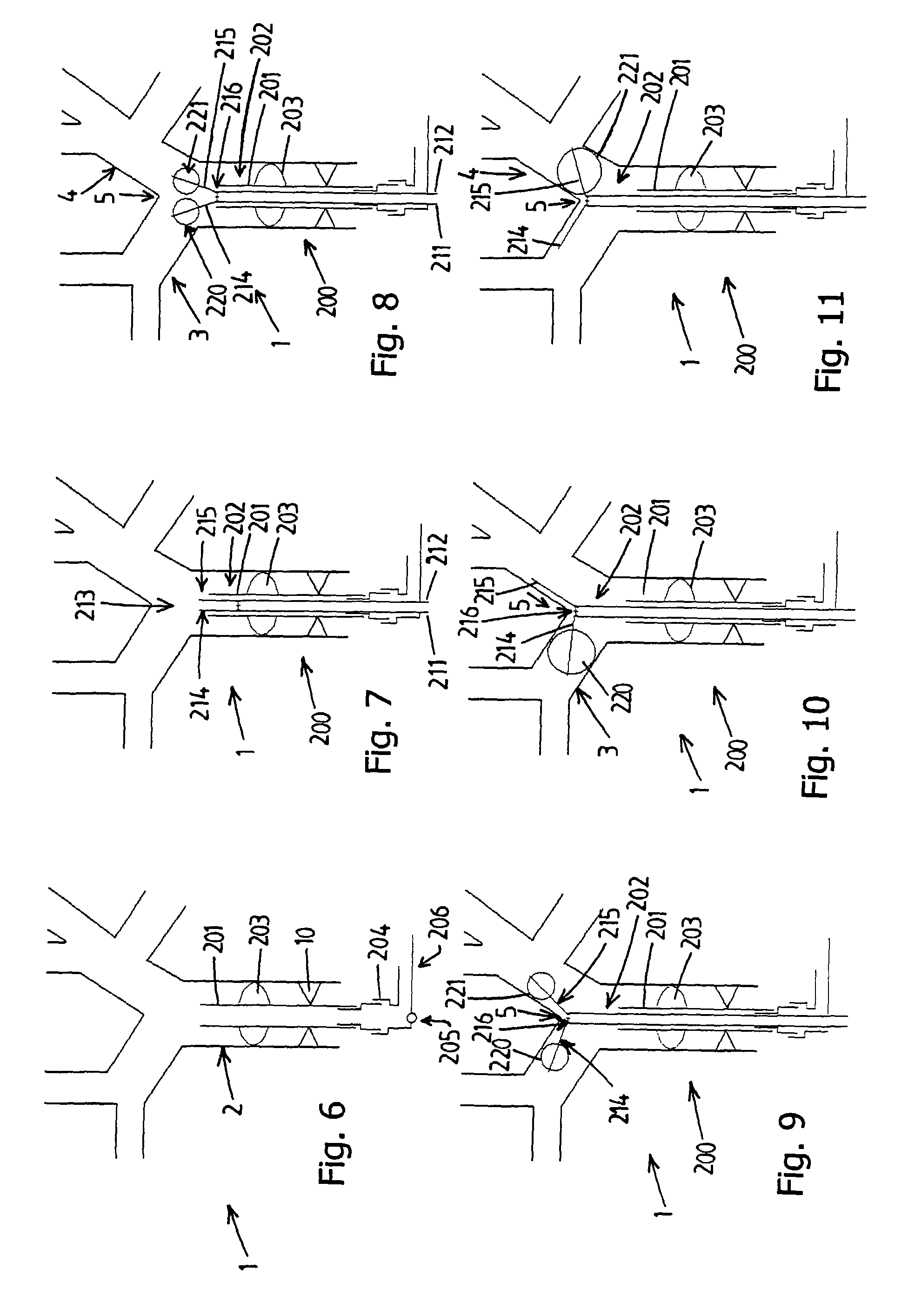 Bronchus blocker and artificial respiration system