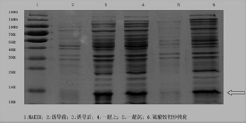 Subunit vaccine based on prokaryotic expression of norovirus antigenic epitope and preparation method of subunit vaccine