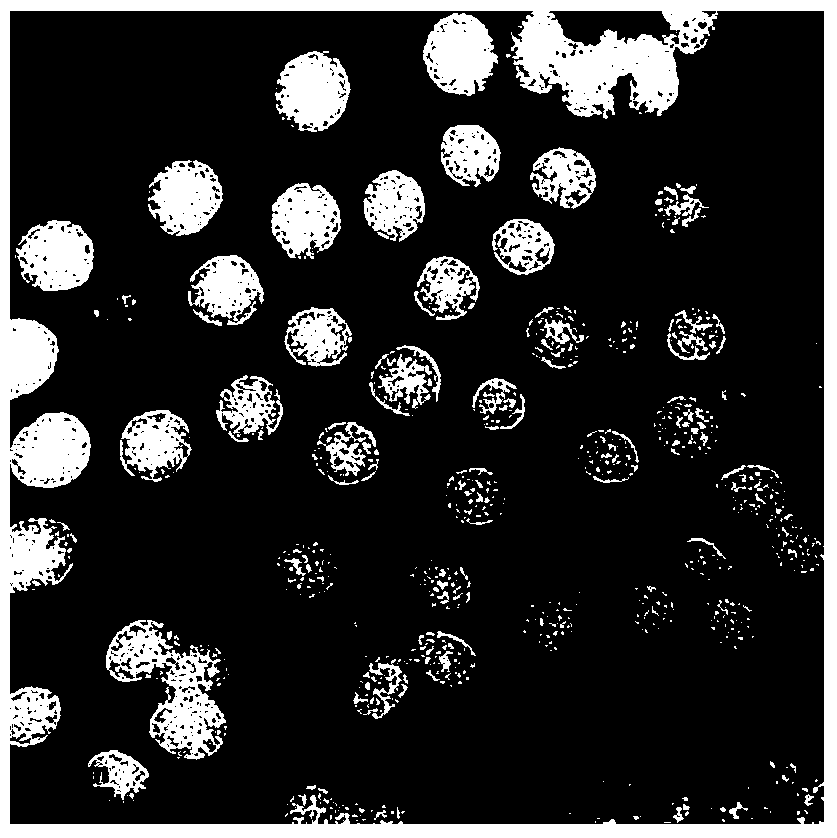 Method for preparing curcumin lipid nano-particle suspension or nano-particles