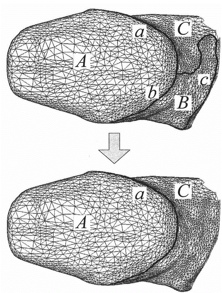 Automatic preparation body neck-edge line extraction method based on MS complex