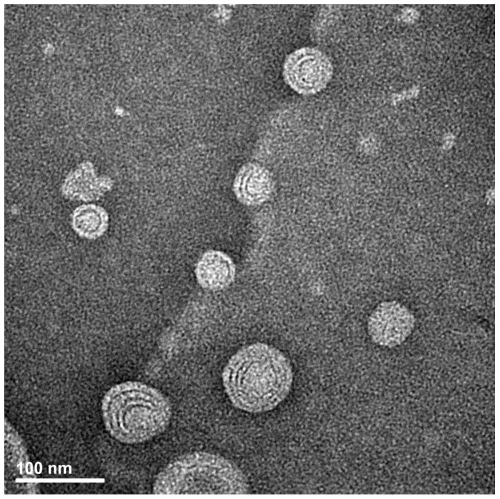 Glycyrrhetinic acid-modified multifunctional ethosome loaded with curcumin and its preparation method and application